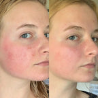 Sérum exfoliant au riz Dr. Melaxin, sérum hydratant pour le visage, adoucissant, élimination des points noirs, hydratant, rétrécissement des pores.