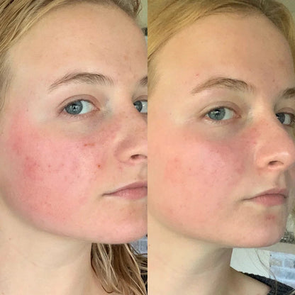 Sérum exfoliant au riz Dr. Melaxin, sérum hydratant pour le visage, adoucissant, élimination des points noirs, hydratant, rétrécissement des pores.