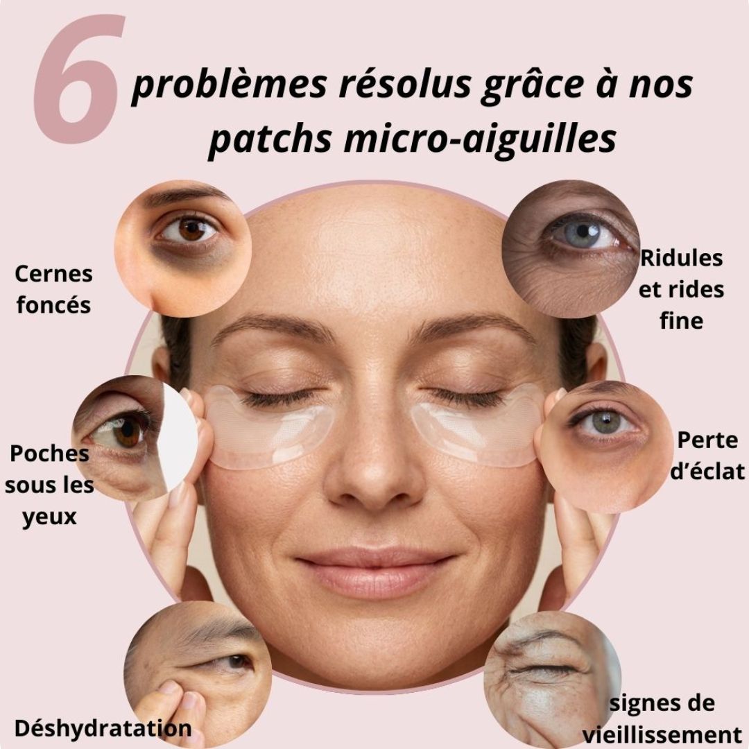 Patchs aux micro-aiguilles KEMORA