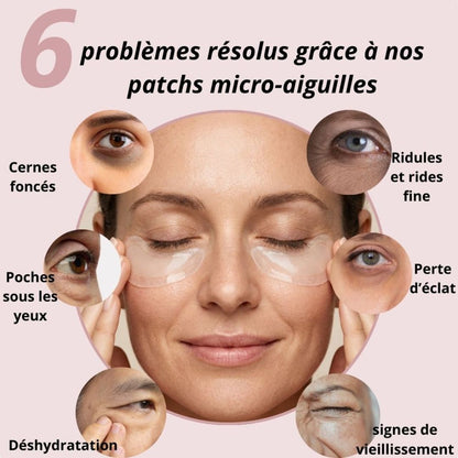 Patchs aux micro-aiguilles KEMORA