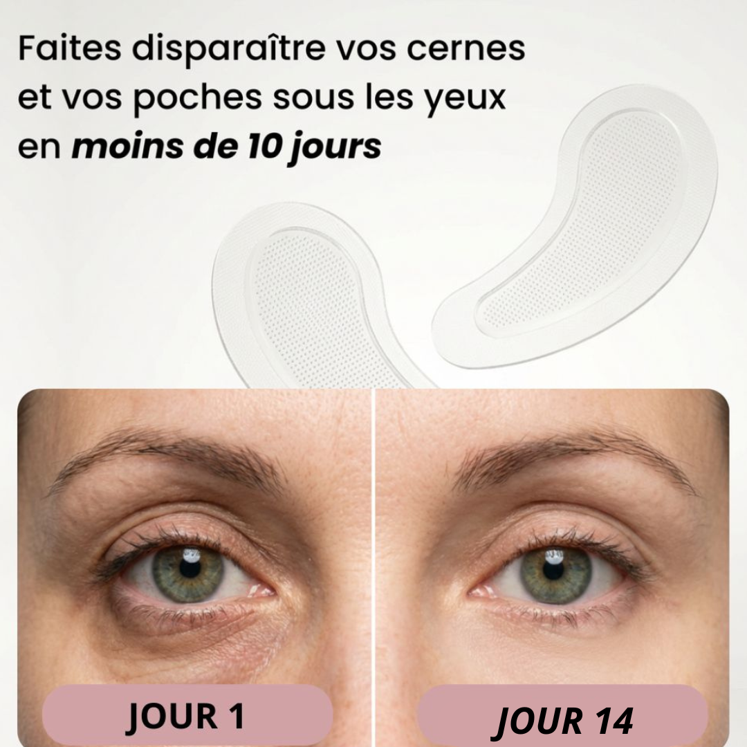 Patchs aux micro-aiguilles KEMORA